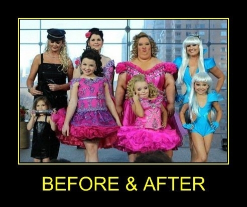 Before and After