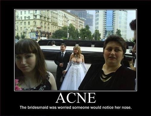 Epic Win