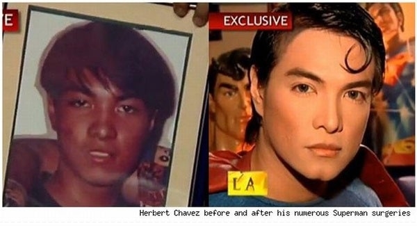 Surgery win or fail?