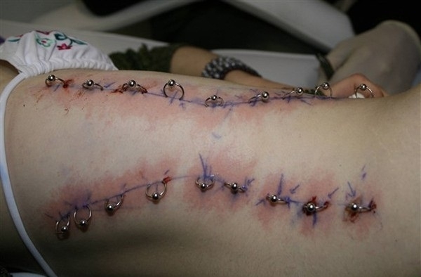 Painful way to propose!