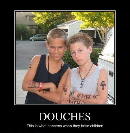Douchebags