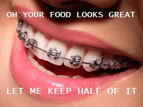 Scumbag braces