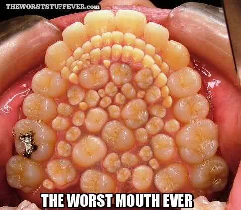 Worst Mouth Ever