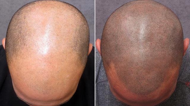 Good idea for a tattoo