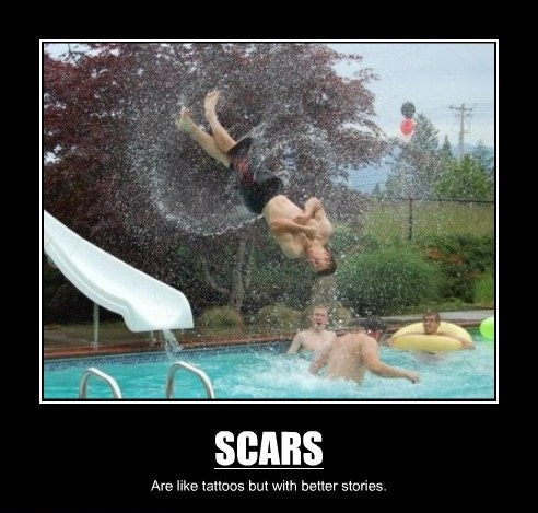 Scars