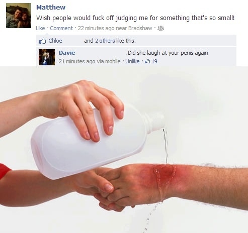 Apply cool water to burn