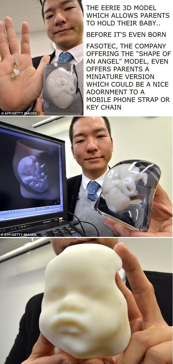 Our baby looks really cute!