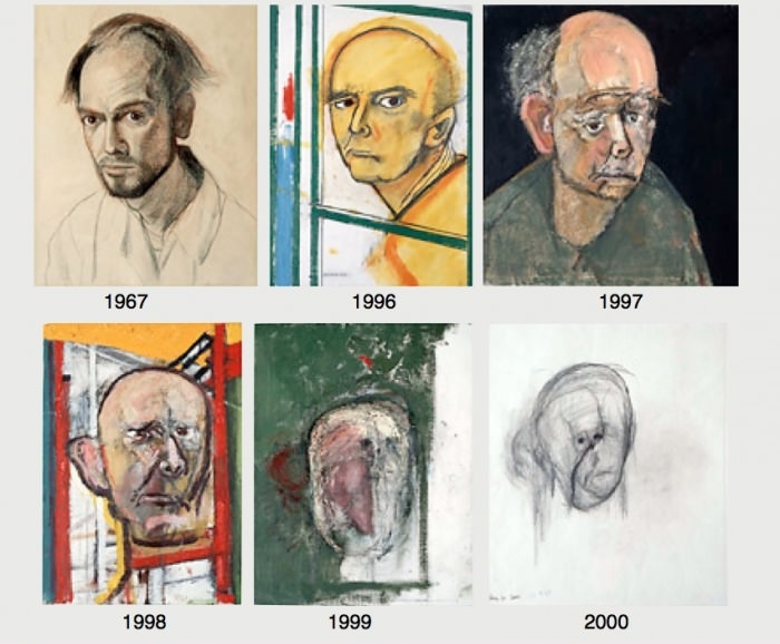 An artist with Alzheimers