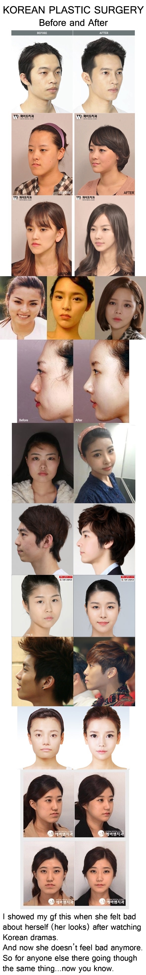 Korean plastic surgery