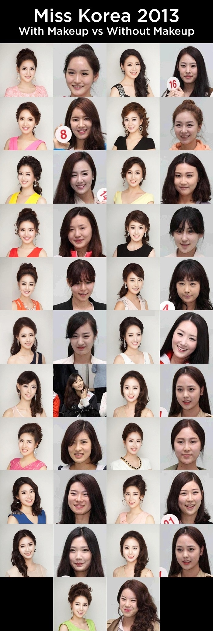 It wasn't plastic surgery