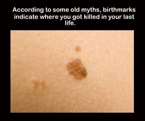 I was shot in the leg