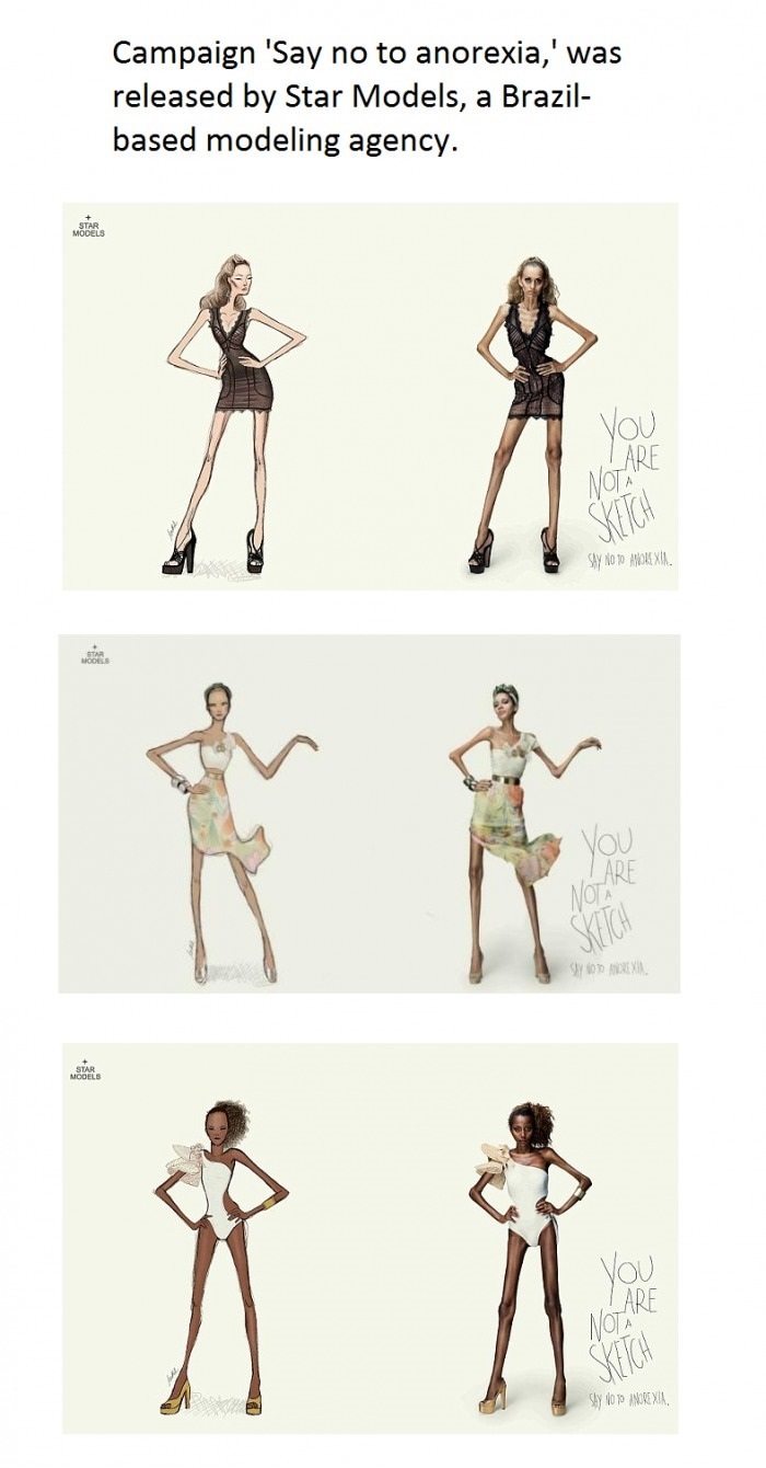 Anti-anorexia campaign
