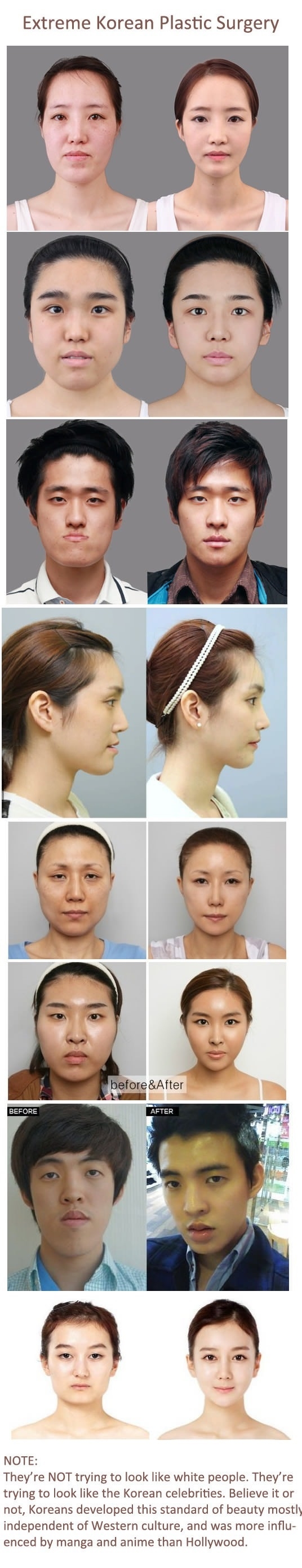 Korean plastic surgery