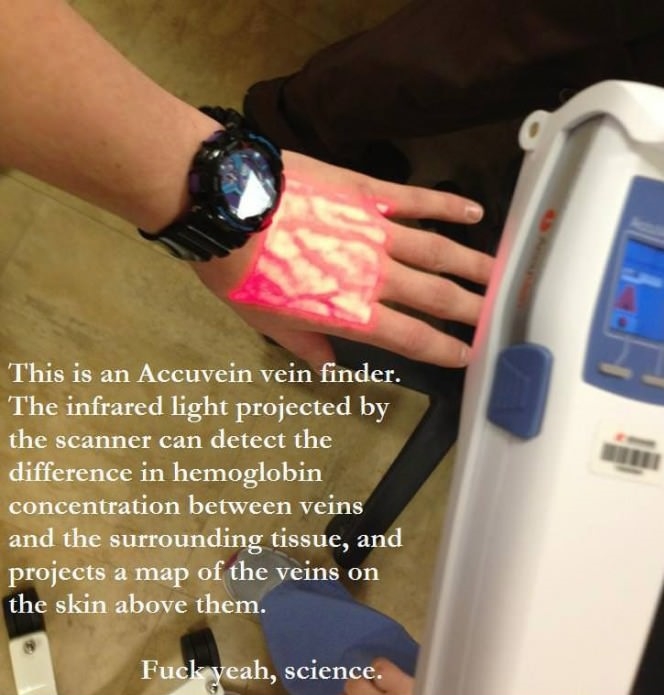 Accuvein vein finder