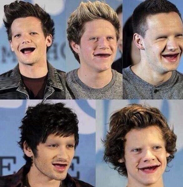 1D without eyebrows
