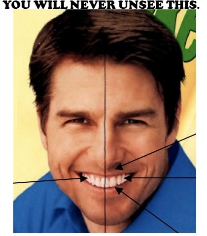 Tom's weird teeth