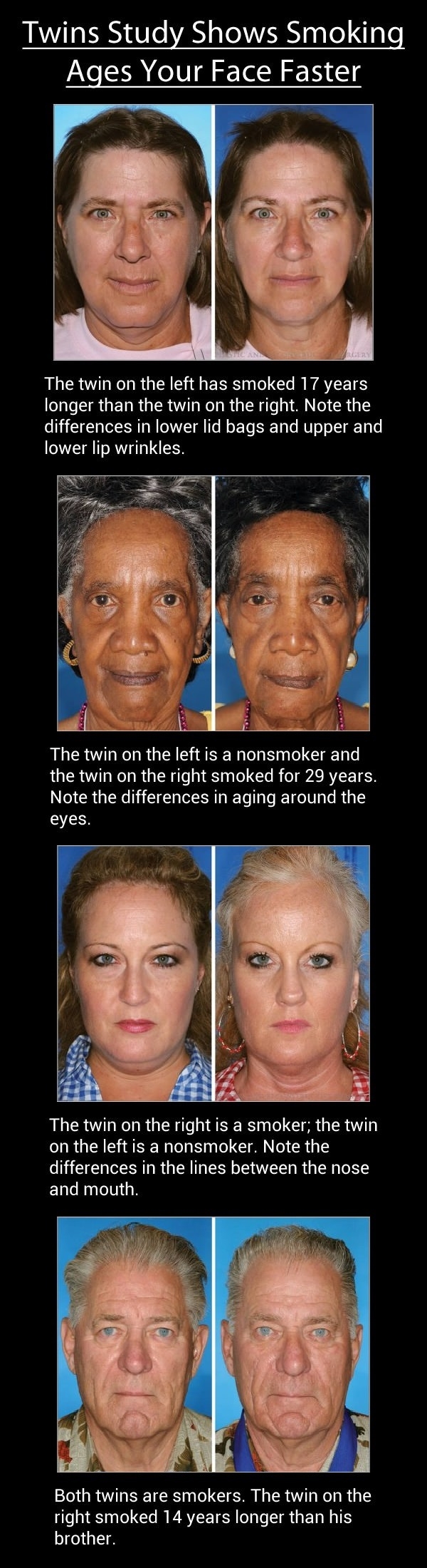 How smoking ages you