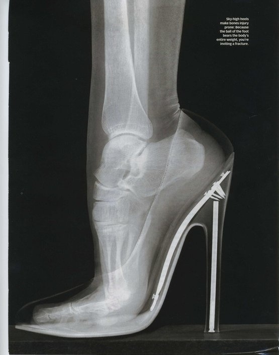 Still wanna wear high heels?