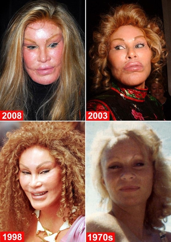 Plastic surgery