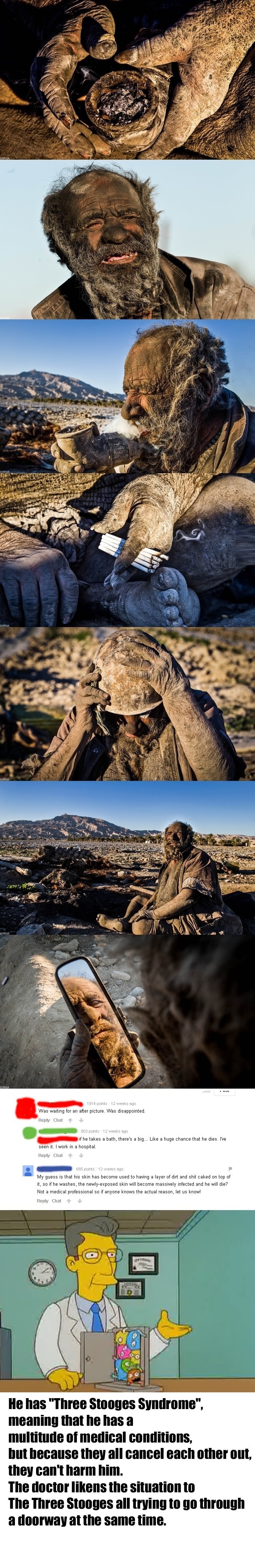 How is he still alive??