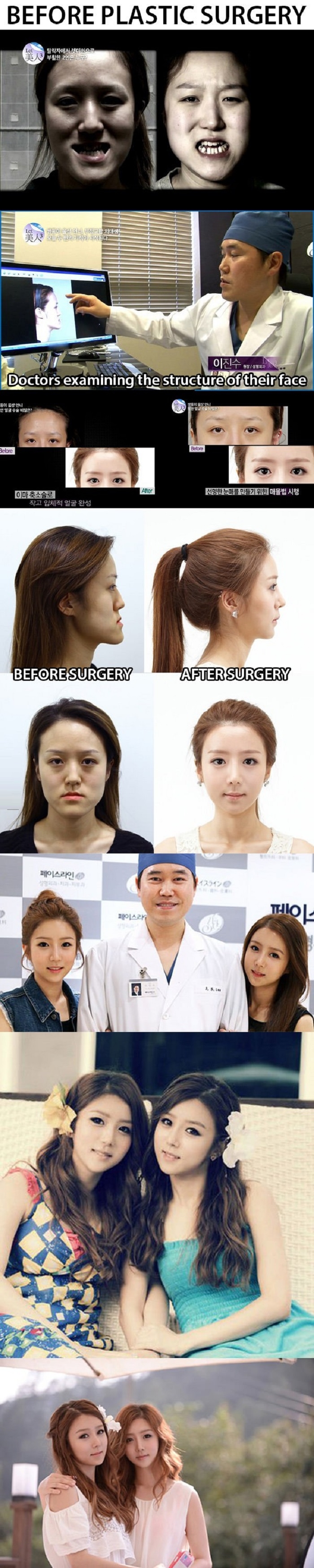 Twins get plastic surgery