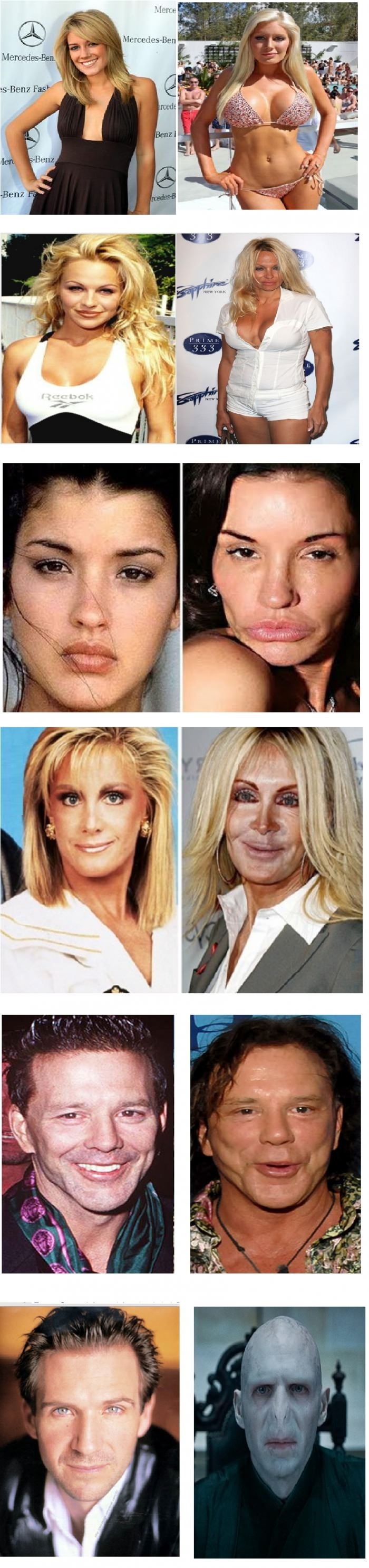 Plastic surgery