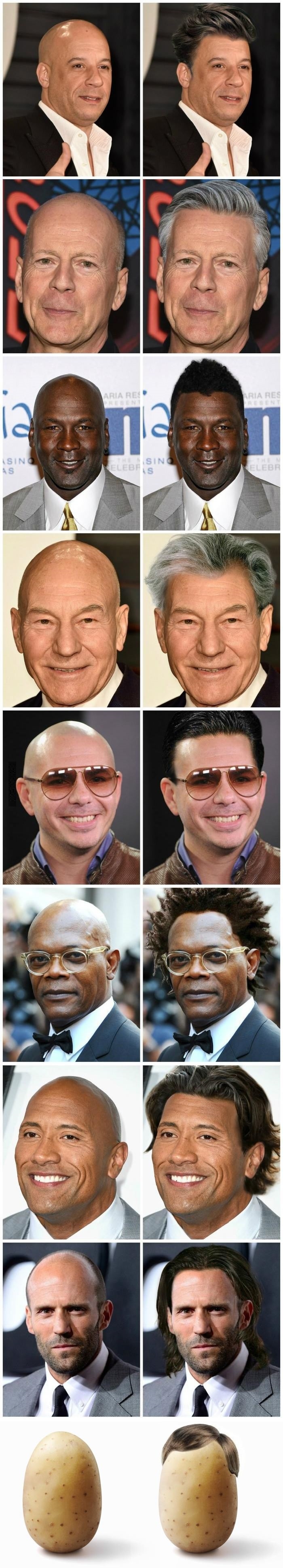 Bald celebs with fabulous hair