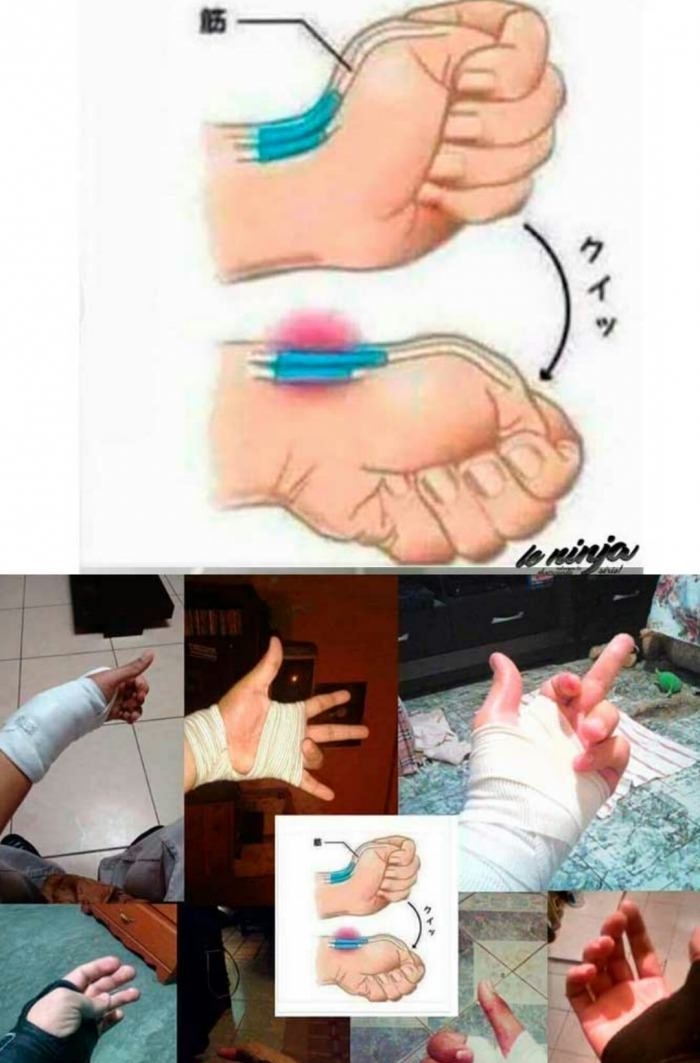 How to break your joint