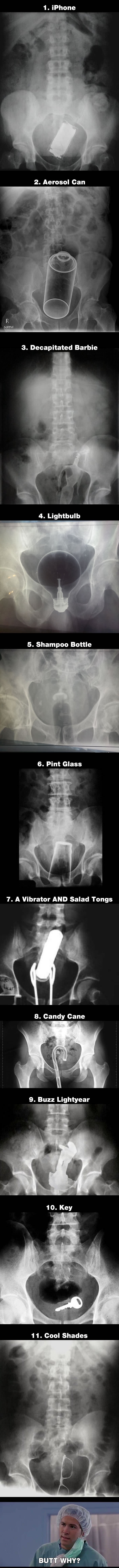 Painful x-rays of stuff that shouldn't go up there