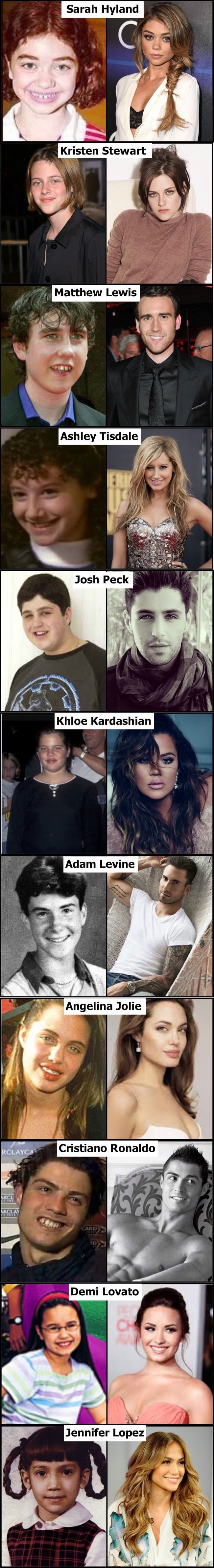 Celebrities then and now