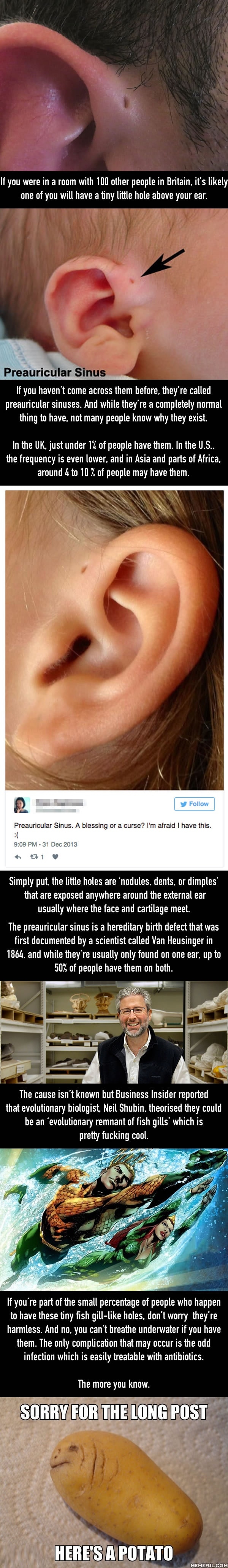 Why some people have little holes above their ears