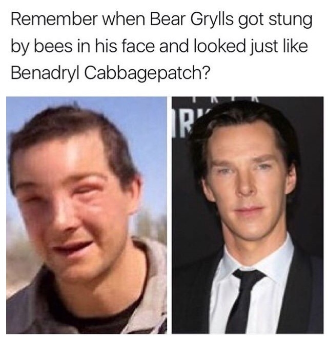 Poor Benadryl Cabbagepatch
