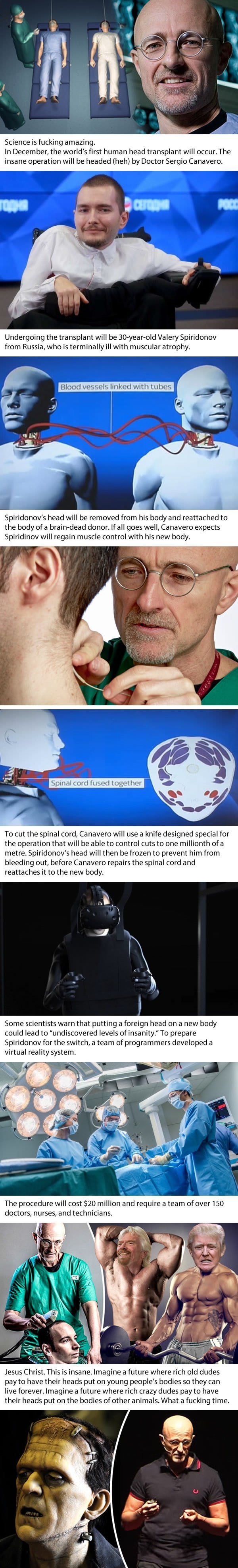 Worlds first human head transplant to take place in 8 months