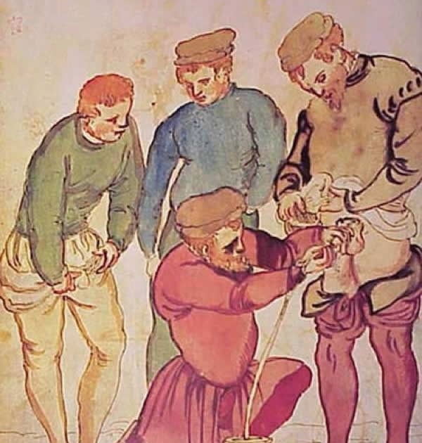 Medieval medical procedures