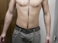 Skinception