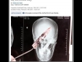 How do you not notice that?