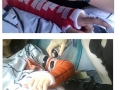 Spider-arm