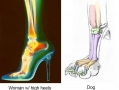 High Heels