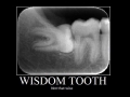 Wisdom Tooth