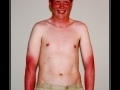 Sun Tanning