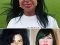 Plastic Surgery Fail
