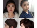 Korean plastic surgery