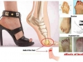 Effects of wearing heels