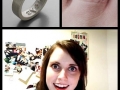 Overly attached ring