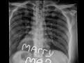 X-Ray Proposal