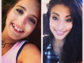 3 yrs & 3 jaw surgeries