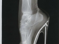 Still wanna wear high heels?