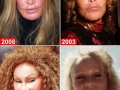Plastic surgery