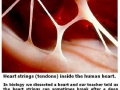Broken heart syndrome
