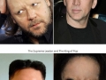 Celebs without eyebrows